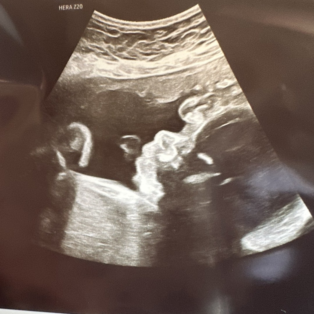 Photo shared by Emily for their Babylist baby registry.