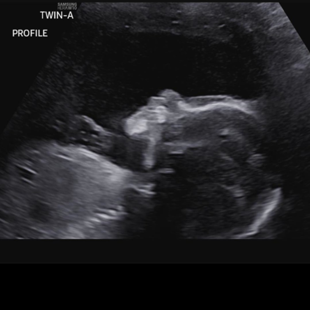 Photo shared by Cesia for their Babylist baby registry.