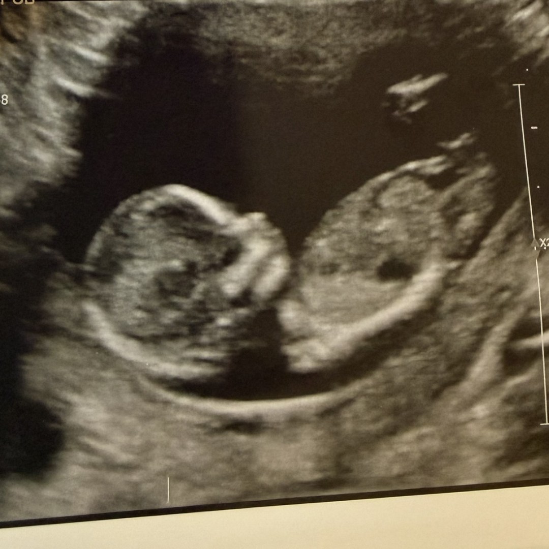 Photo shared by Brooklynn for their Babylist baby registry.