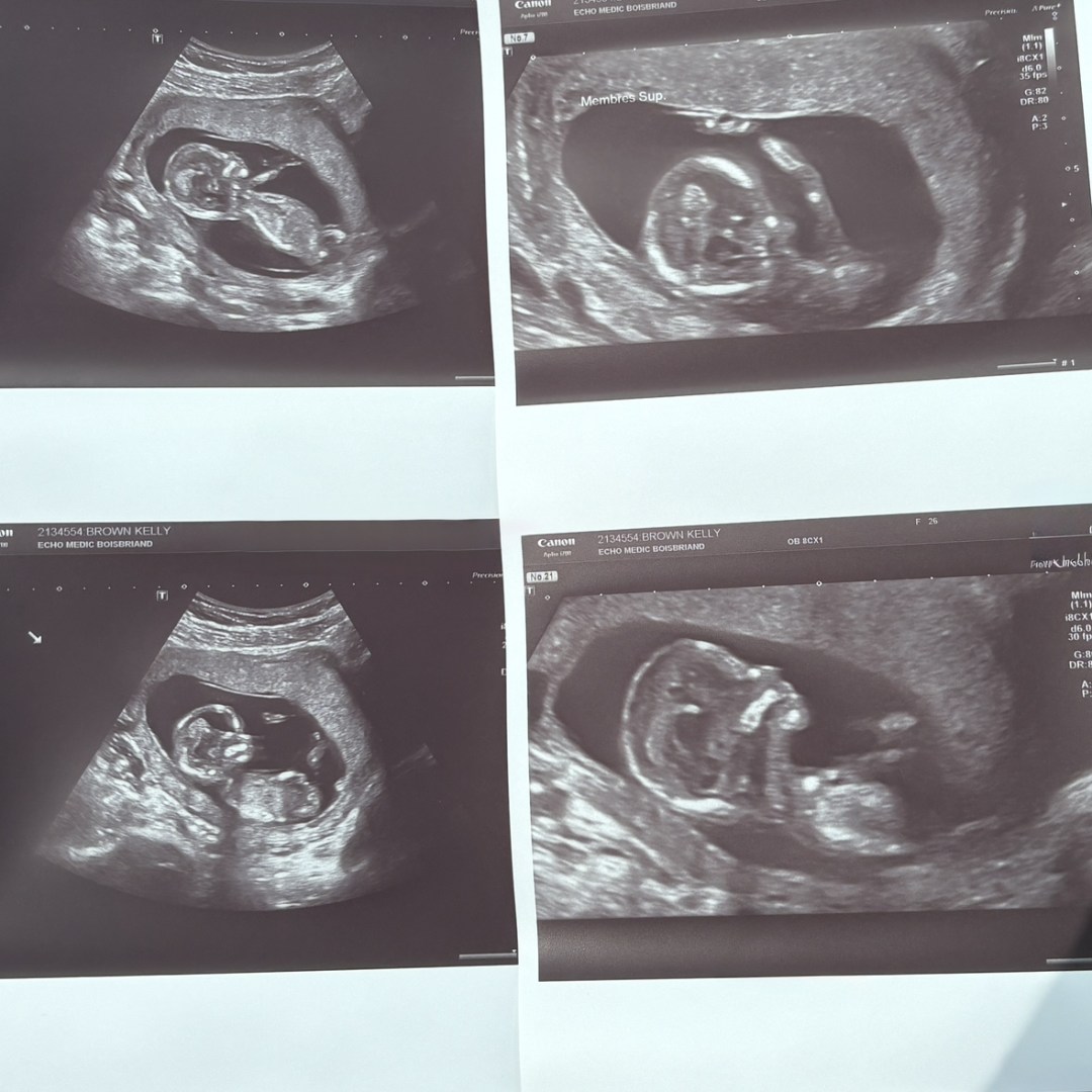 Photo shared by Kelly for their Babylist baby registry.