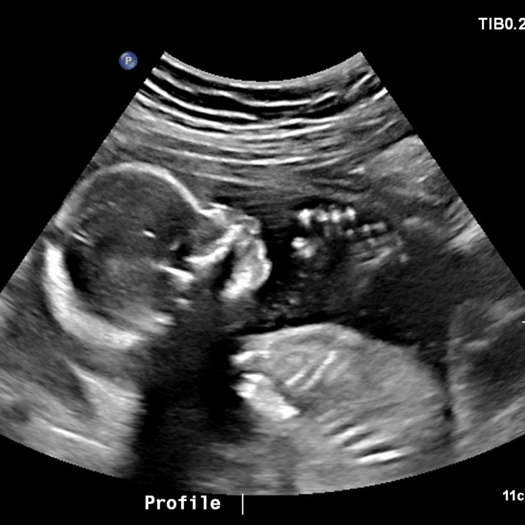 Photo shared by Brianna for their Babylist baby registry.