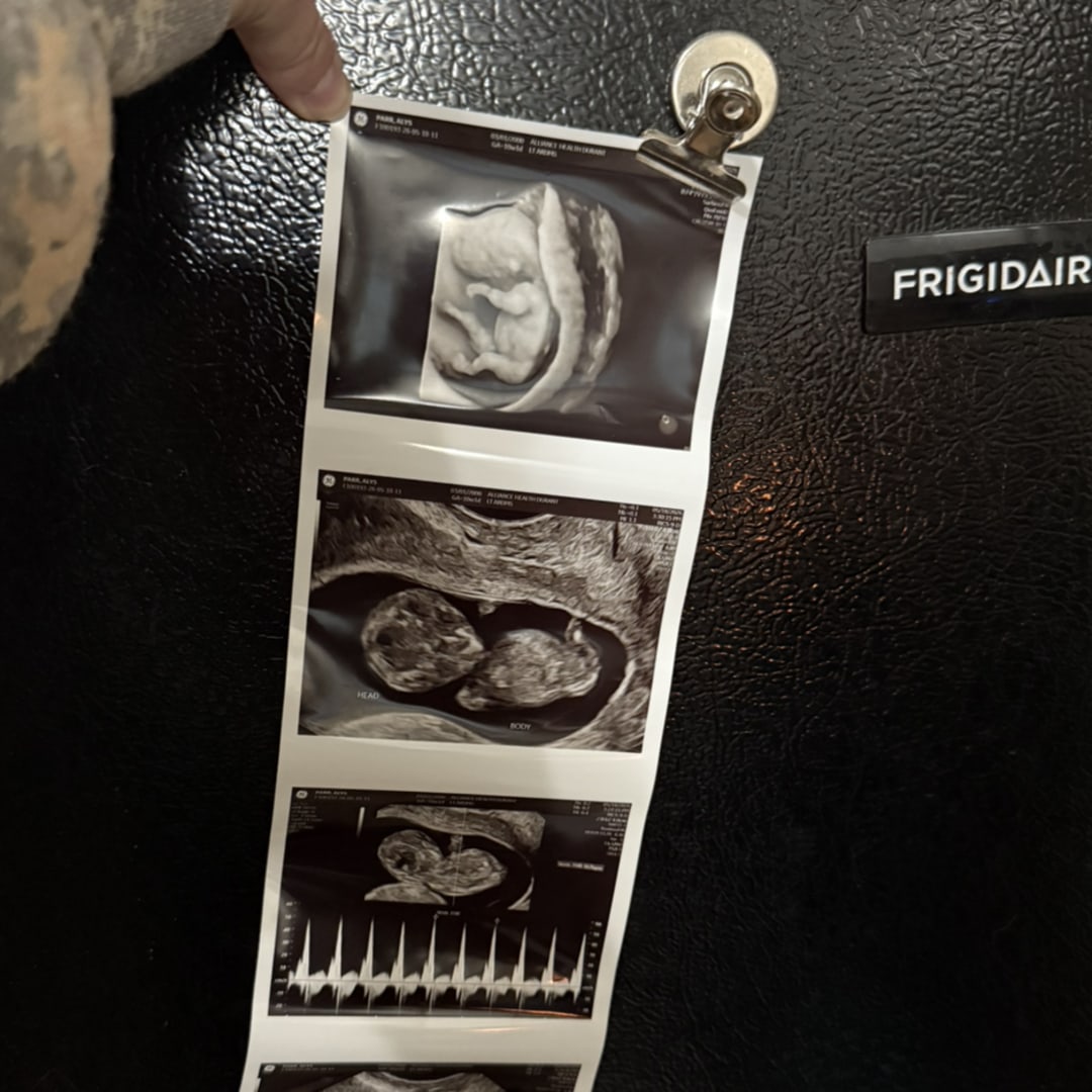 Photo shared by Alys for their Babylist baby registry.