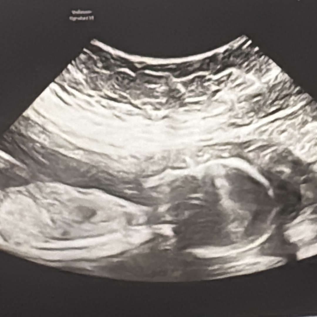 Photo shared by Susana & Ethan for their Babylist baby registry.