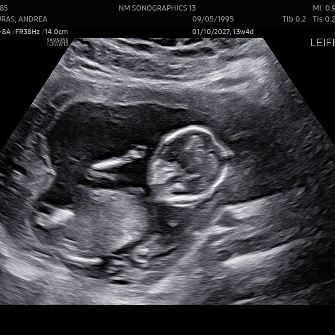 Photo shared by Andrea for their Babylist baby registry.