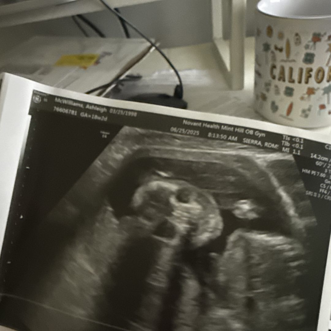 Photo shared by Ashleigh for their Babylist baby registry.