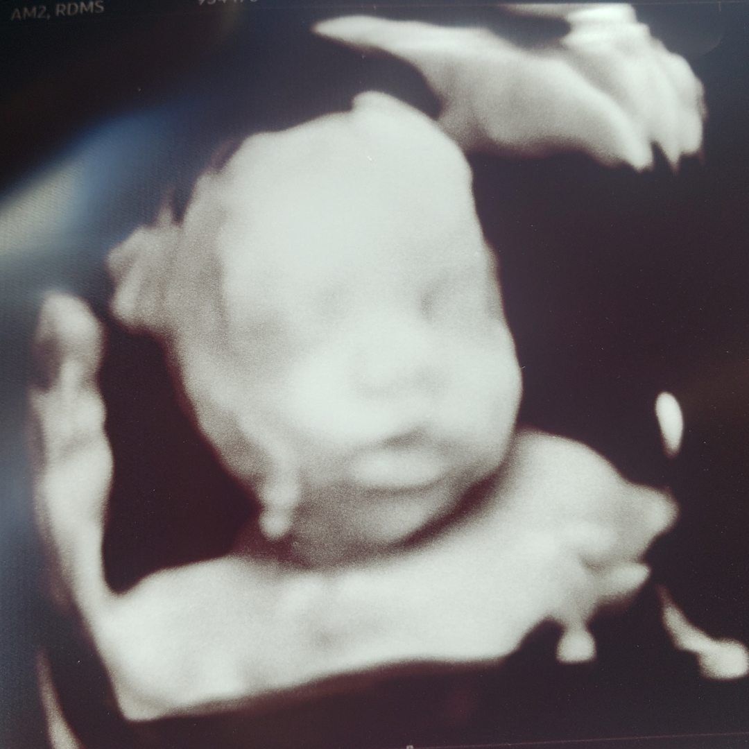 Photo shared by Valerie for their Babylist baby registry.
