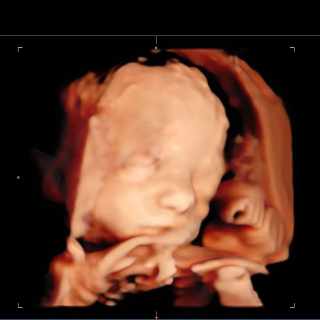 Photo shared by Haley for their Babylist baby registry.