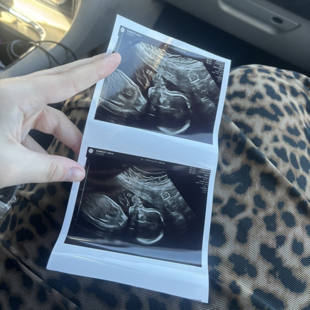 Photo shared by Jayla for their Babylist baby registry.