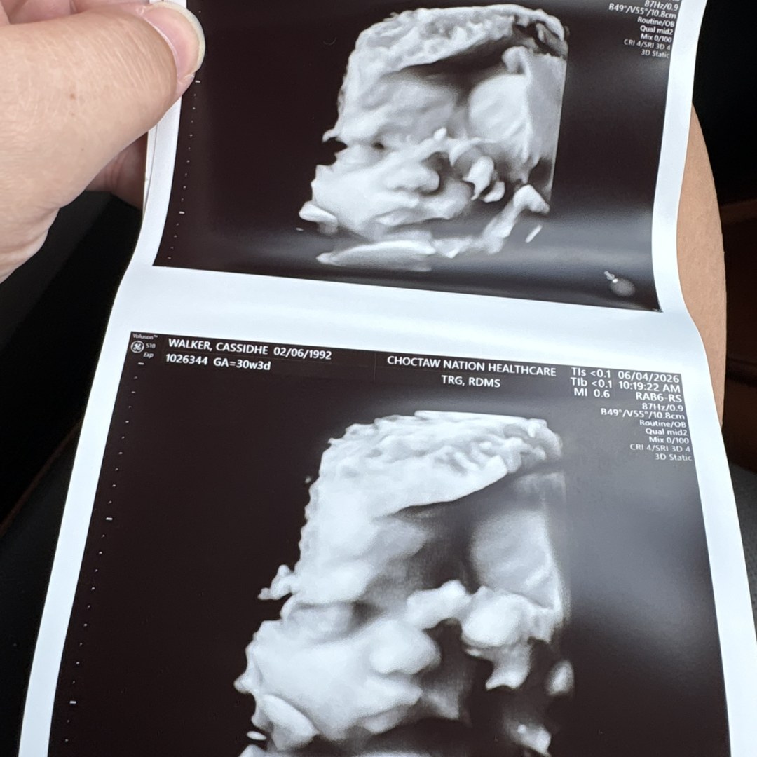 Photo shared by Cassidhe for their Babylist baby registry.
