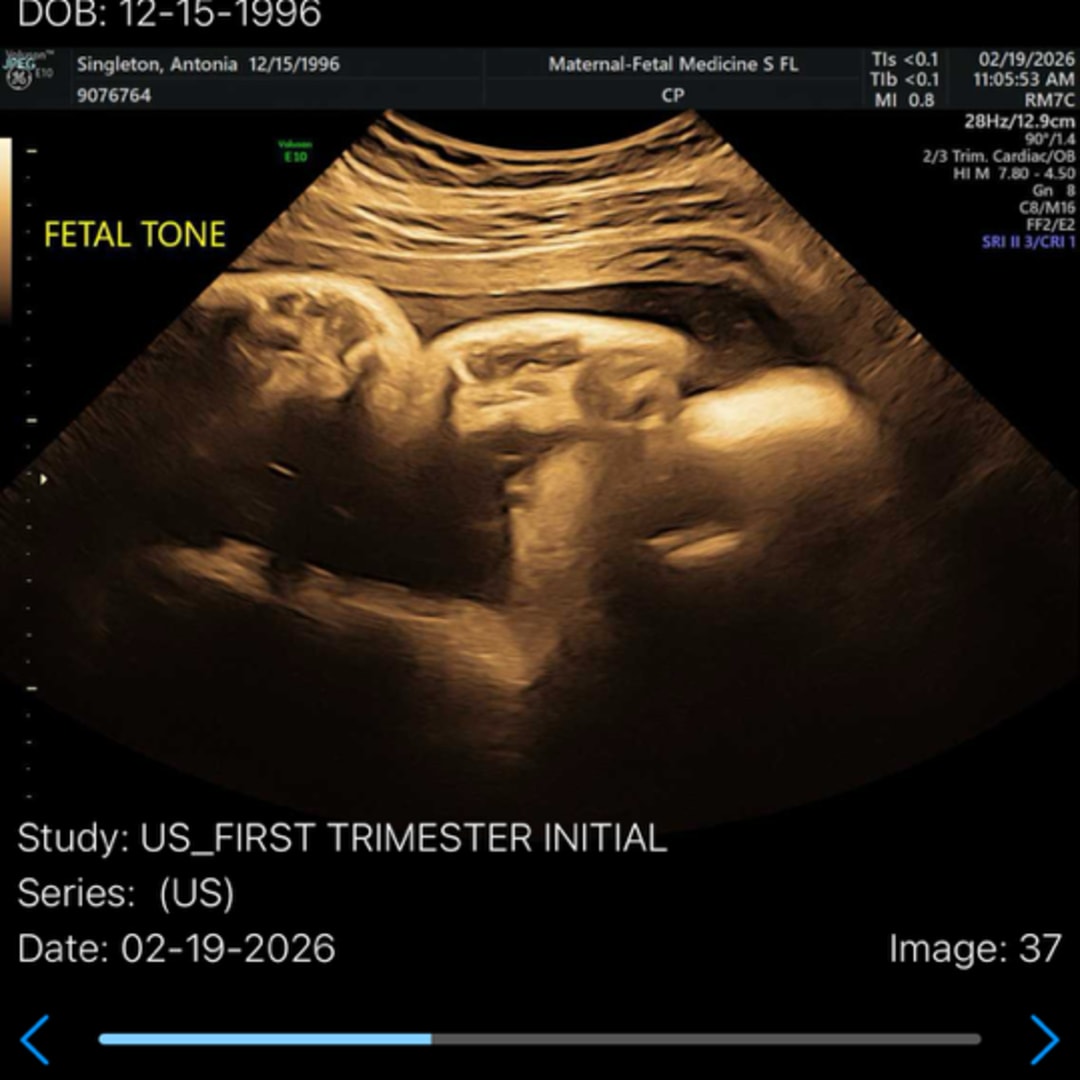 Photo shared by Antonia for their Babylist baby registry.