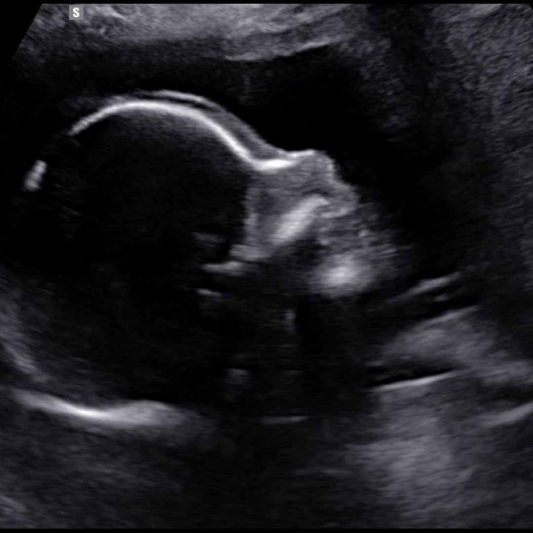 Photo shared by Kenia for their Babylist baby registry.