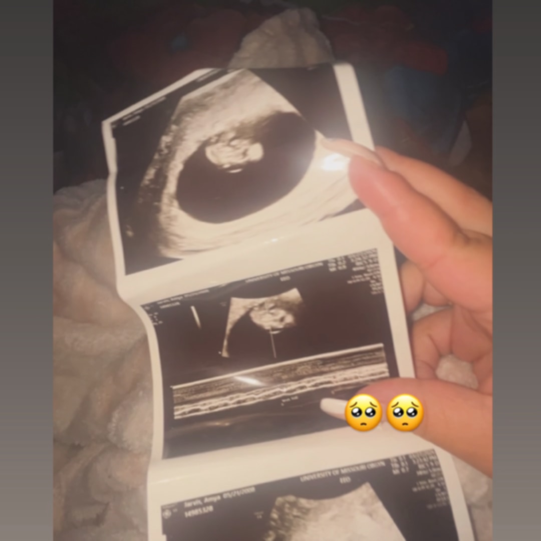 Photo shared by Amya for their Babylist baby registry.