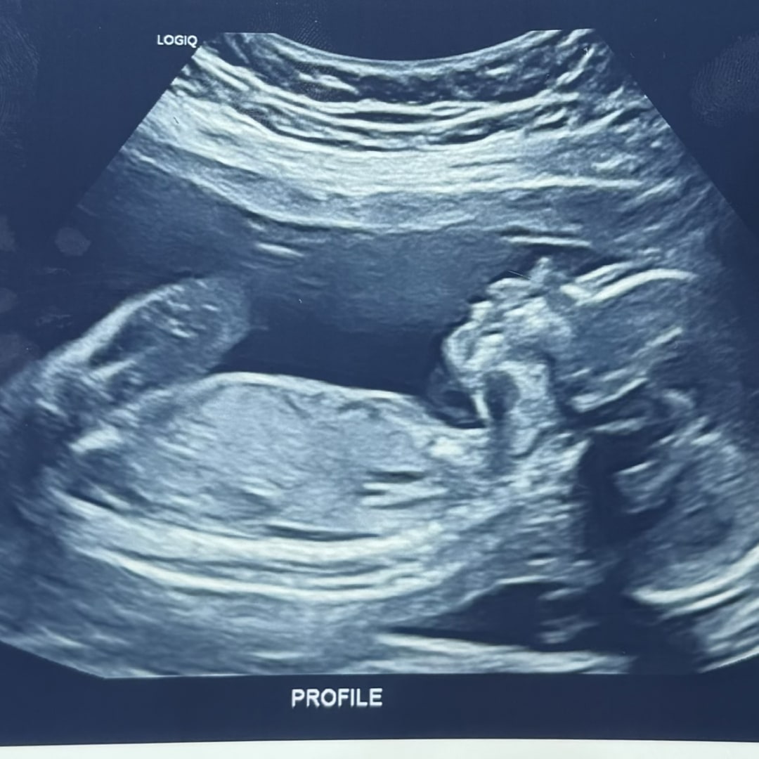 Photo shared by Crisanta for their Babylist baby registry.
