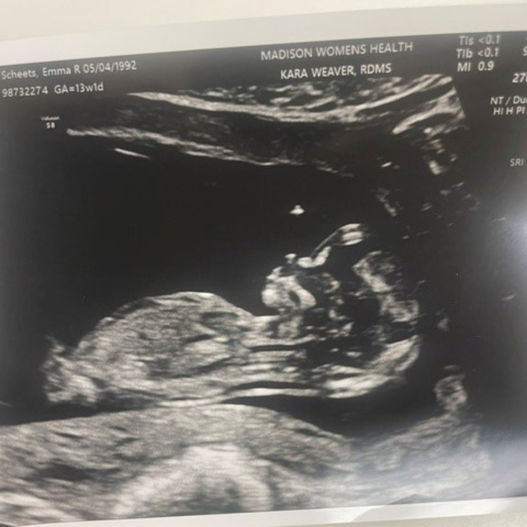 Photo shared by Emma for their Babylist baby registry.