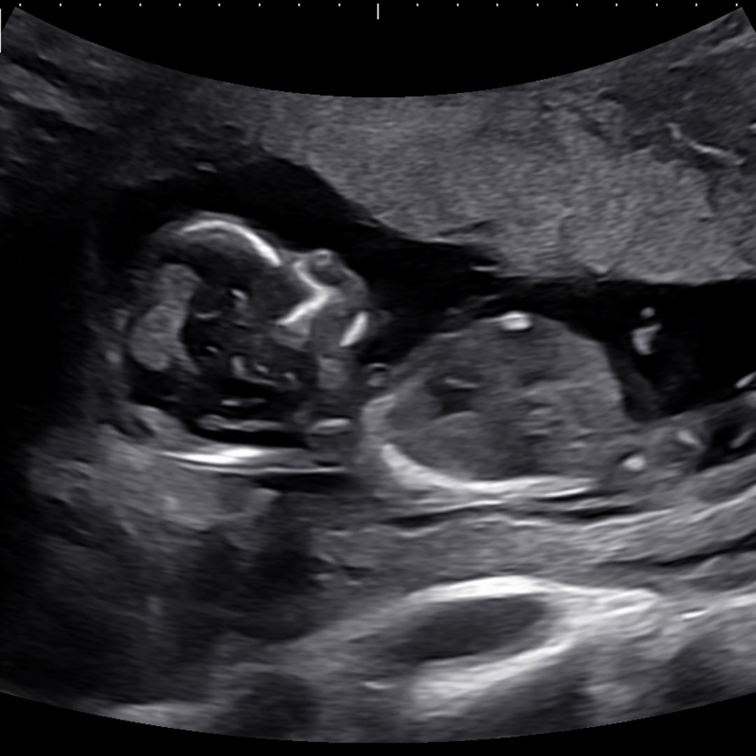 Photo shared by Joniece for their Babylist baby registry.