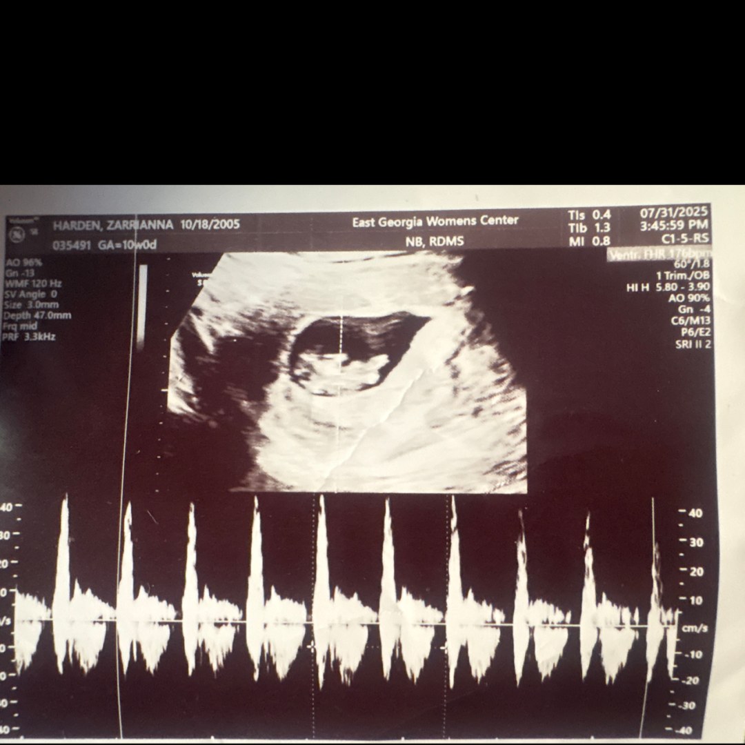 Photo shared by Zarriana for their Babylist baby registry.