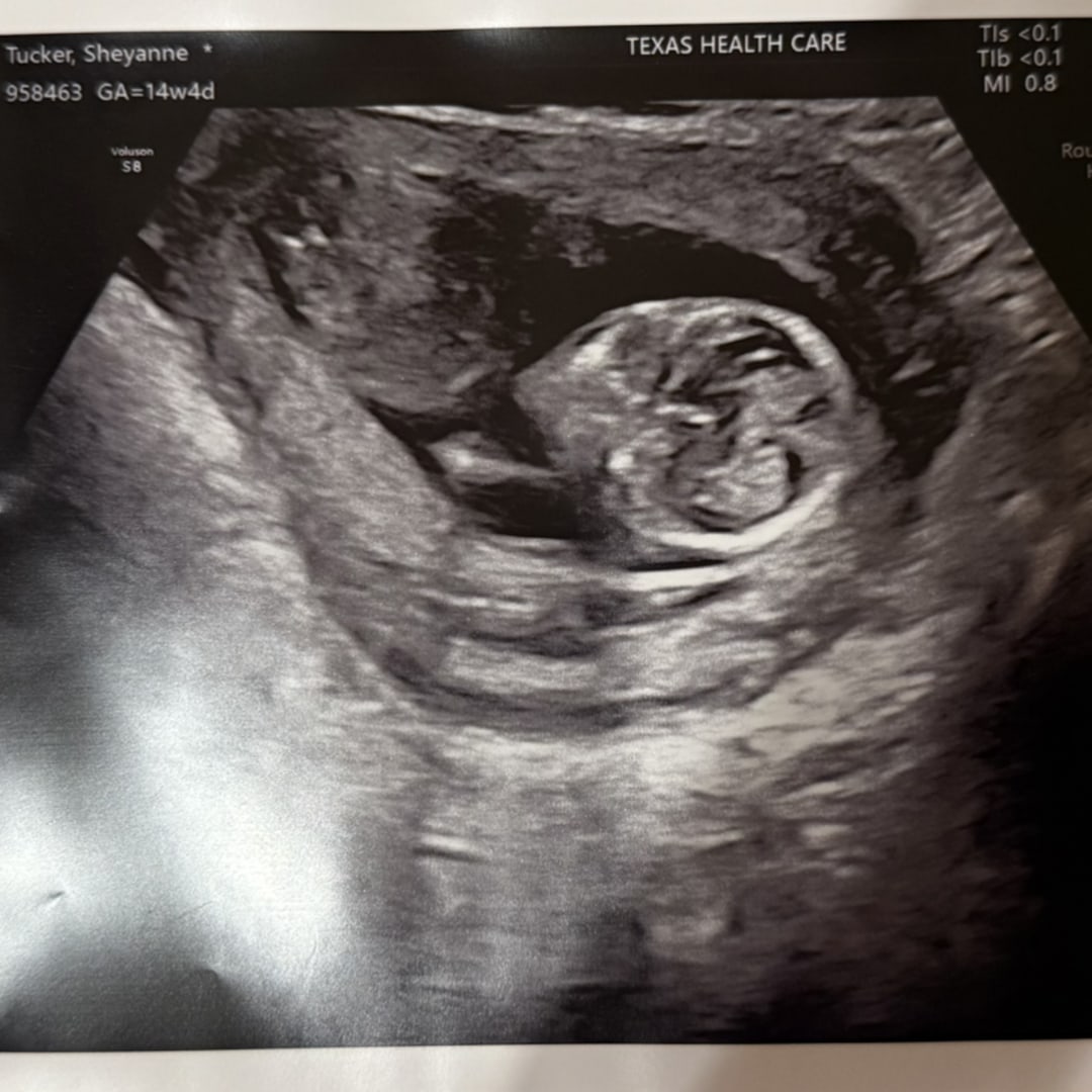 Photo shared by Sheyanne for their Babylist baby registry.