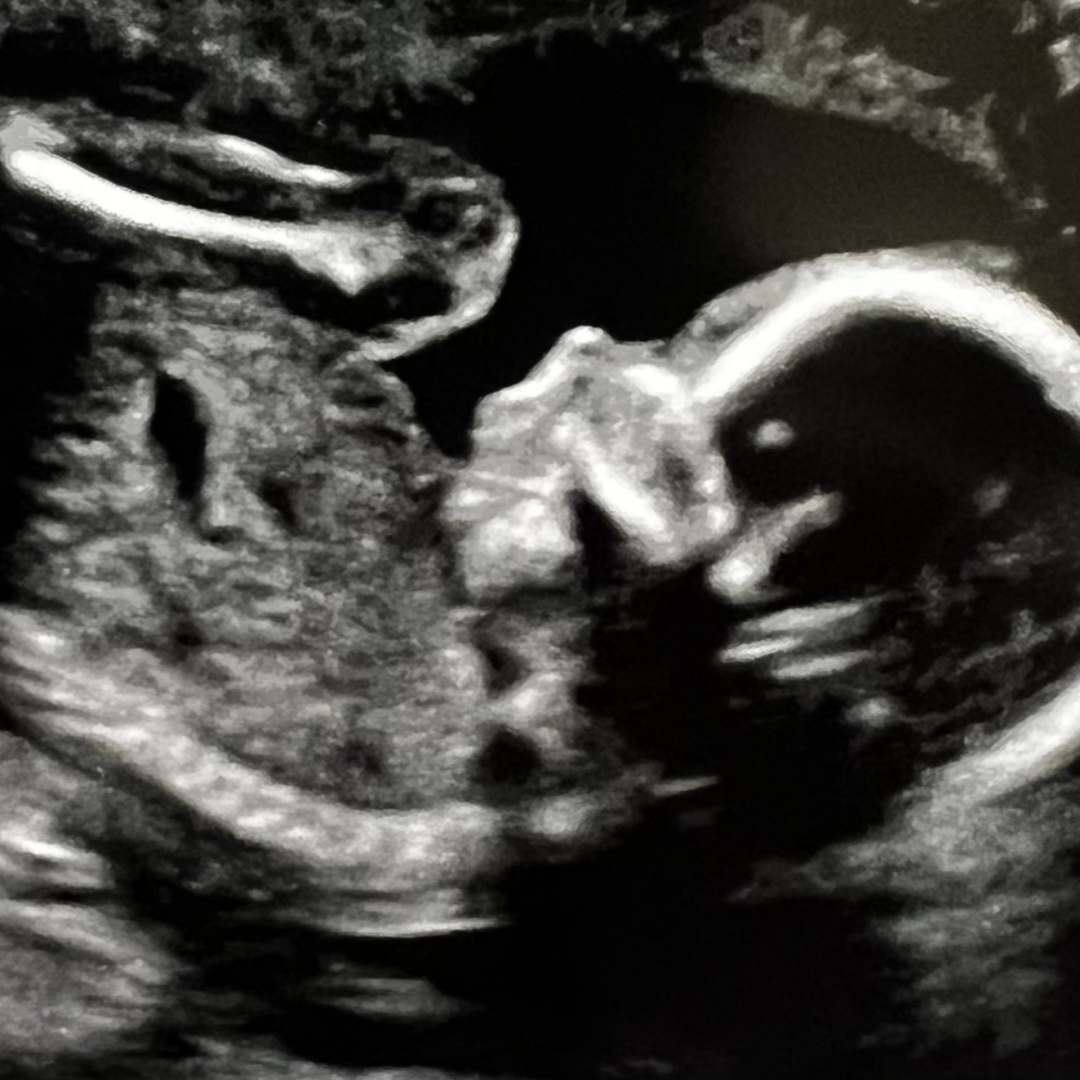 Photo shared by Emily for their Babylist baby registry.