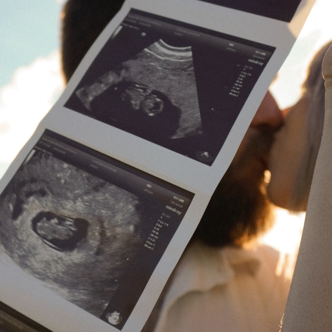 Photo shared by Jacqueline for their Babylist baby registry.