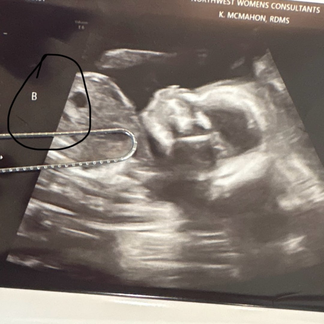 Photo shared by Catalina for their Babylist baby registry.