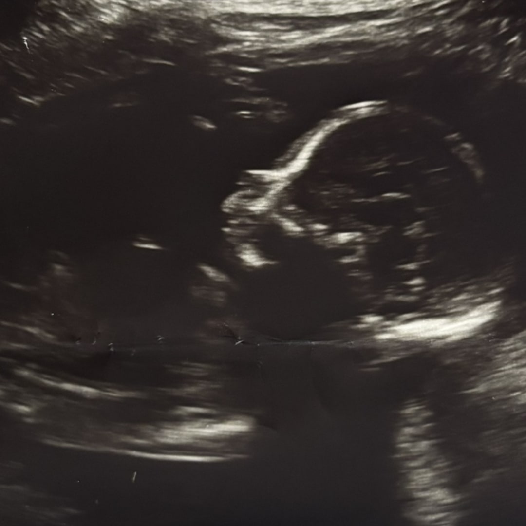 Photo shared by Cecilia for their Babylist baby registry.