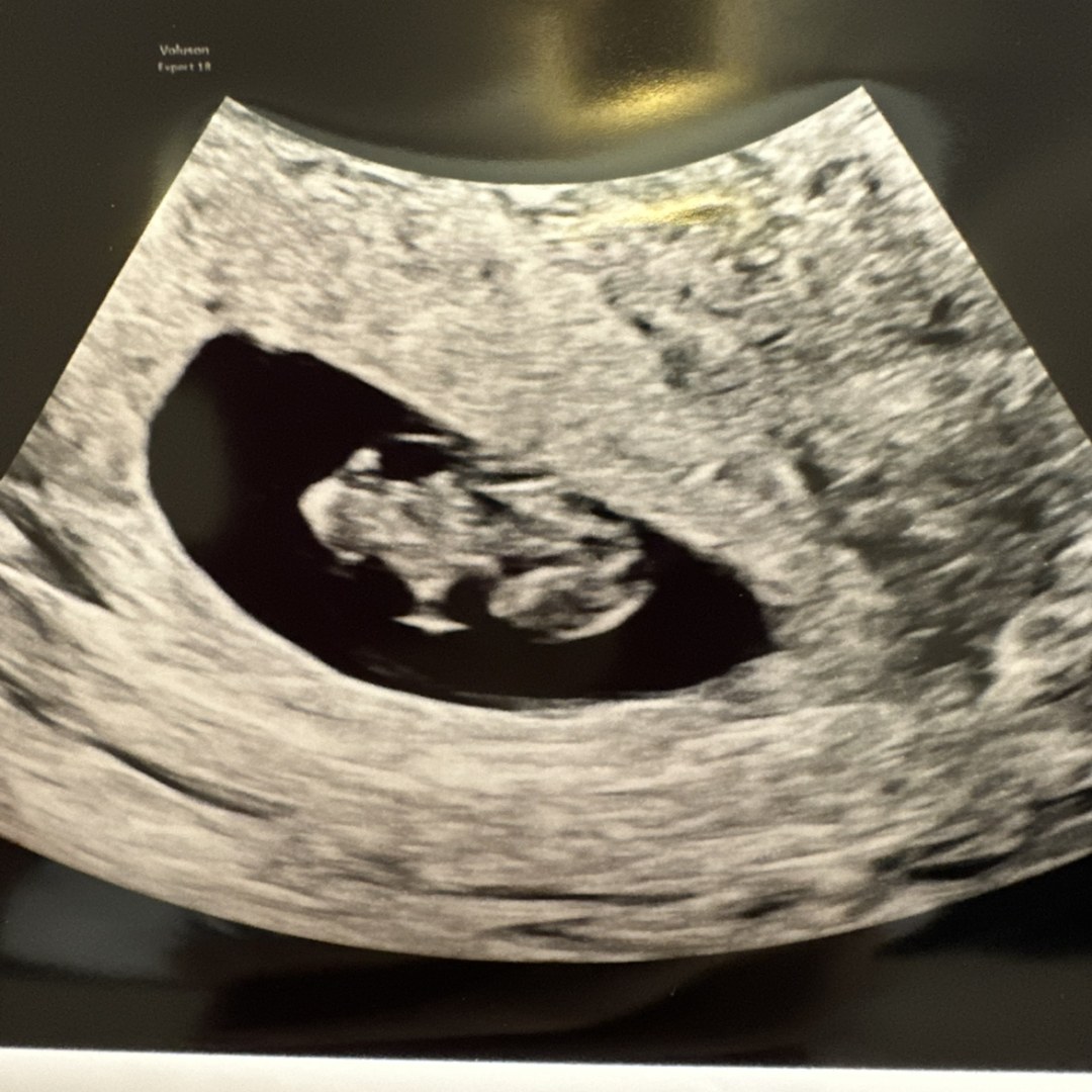 Photo shared by Karla for their Babylist baby registry.