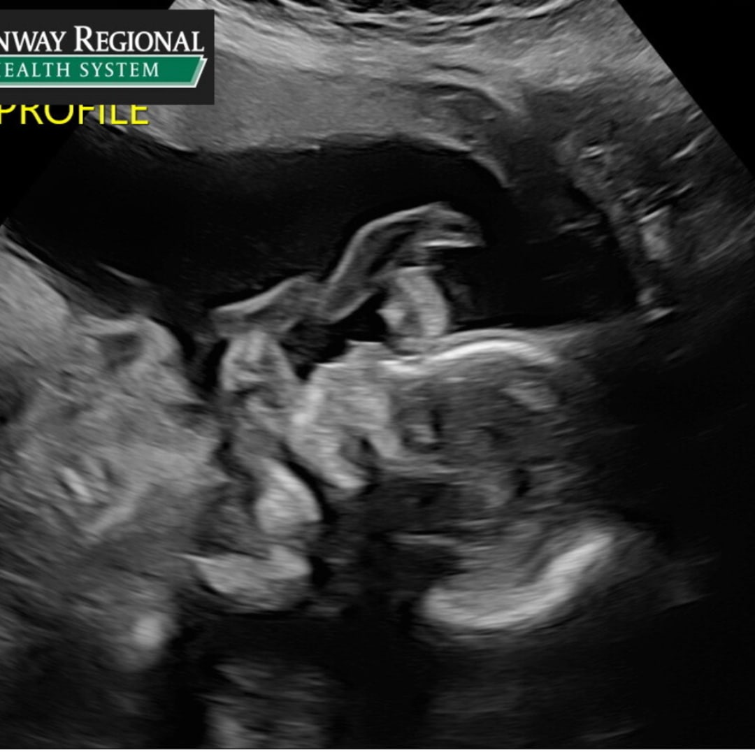 Photo shared by Ashley for their Babylist baby registry.