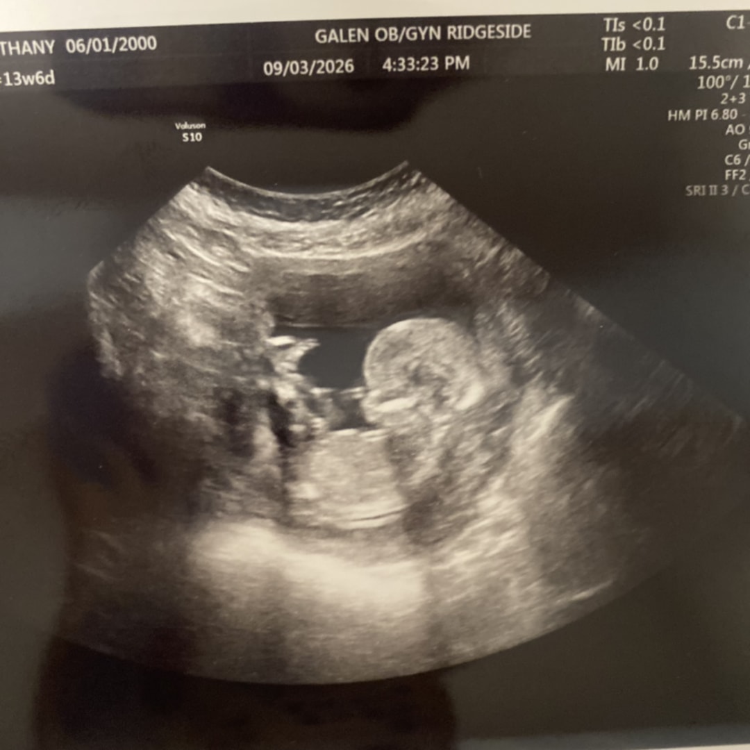 Photo shared by Bethany for their Babylist baby registry.
