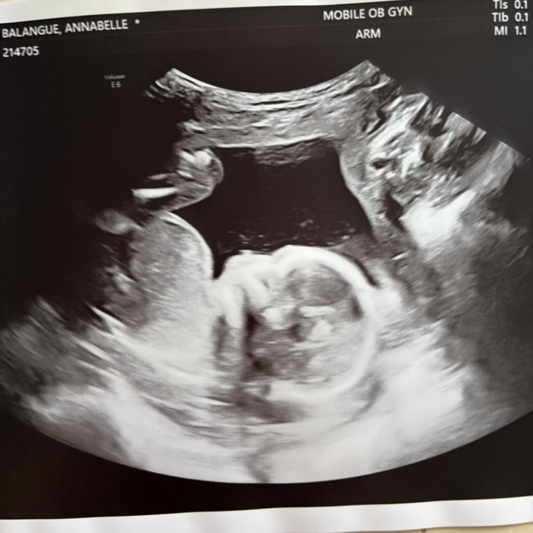 Photo shared by Annabelle for their Babylist baby registry.