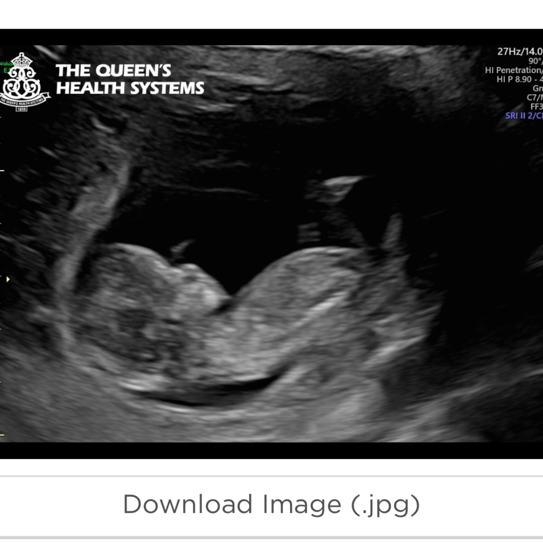 Photo shared by Christopher for their Babylist baby registry.