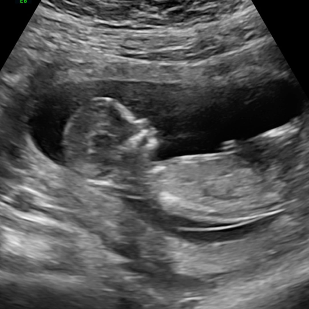 Photo shared by Arianna for their Babylist baby registry.