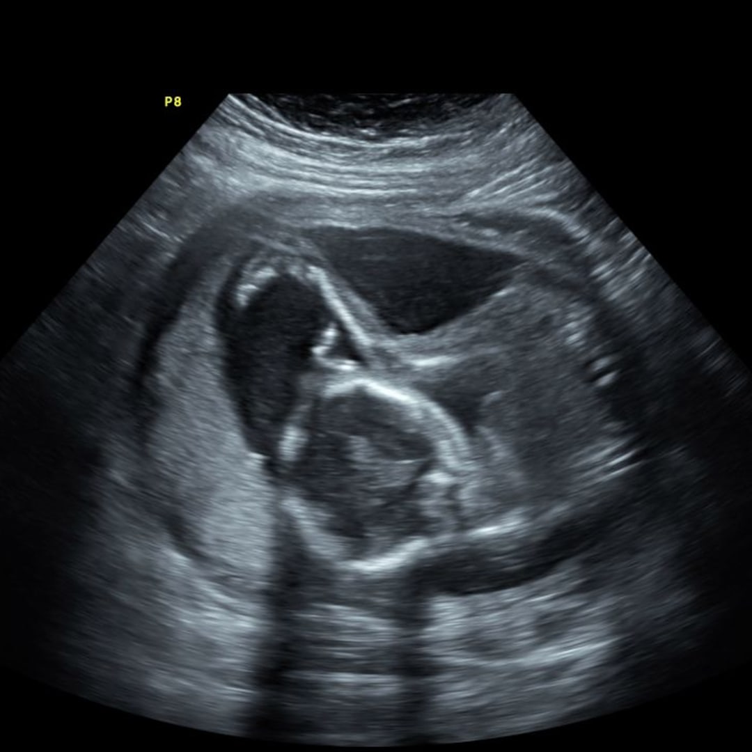 Photo shared by Dallas for their Babylist baby registry.
