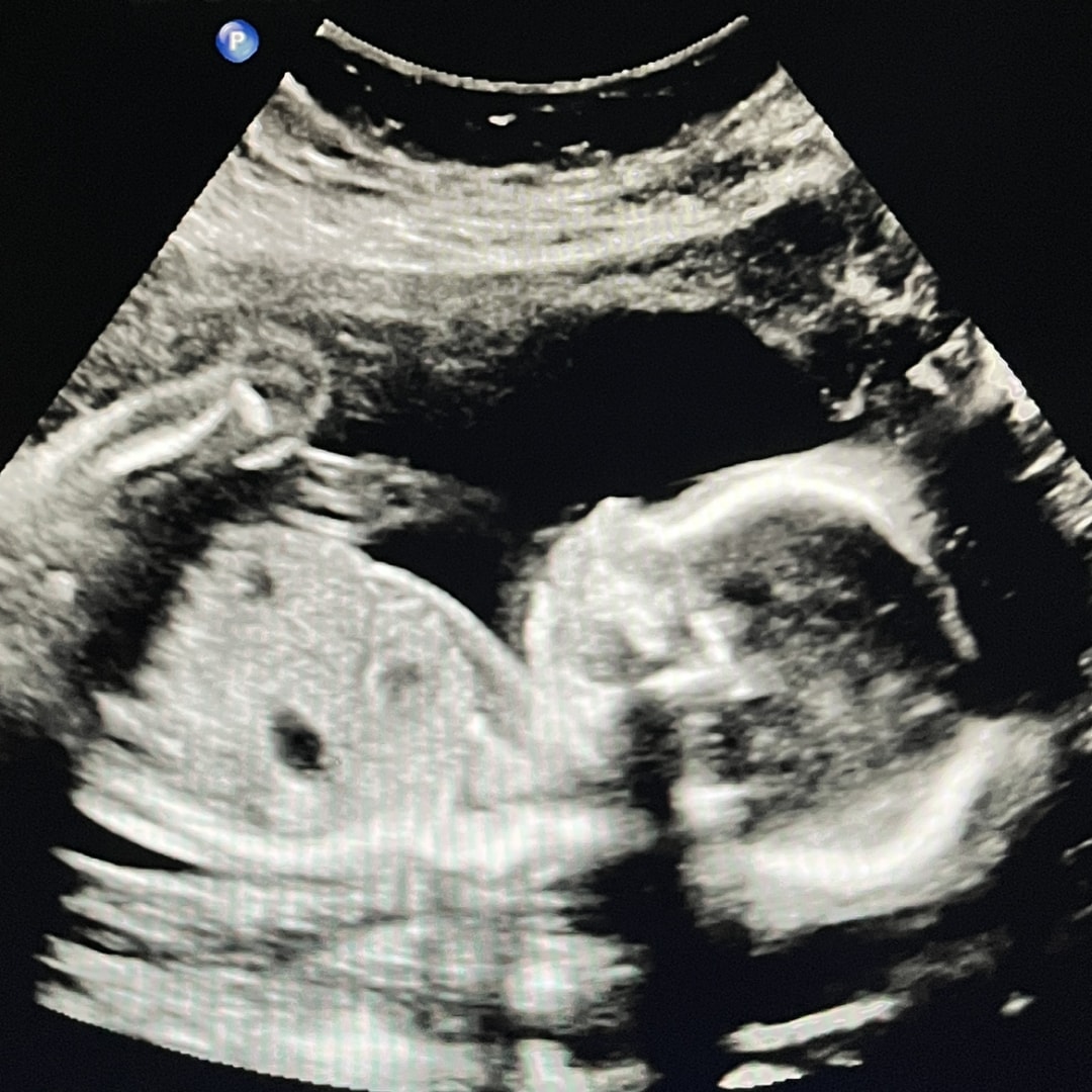 Photo shared by Robin for their Babylist baby registry.