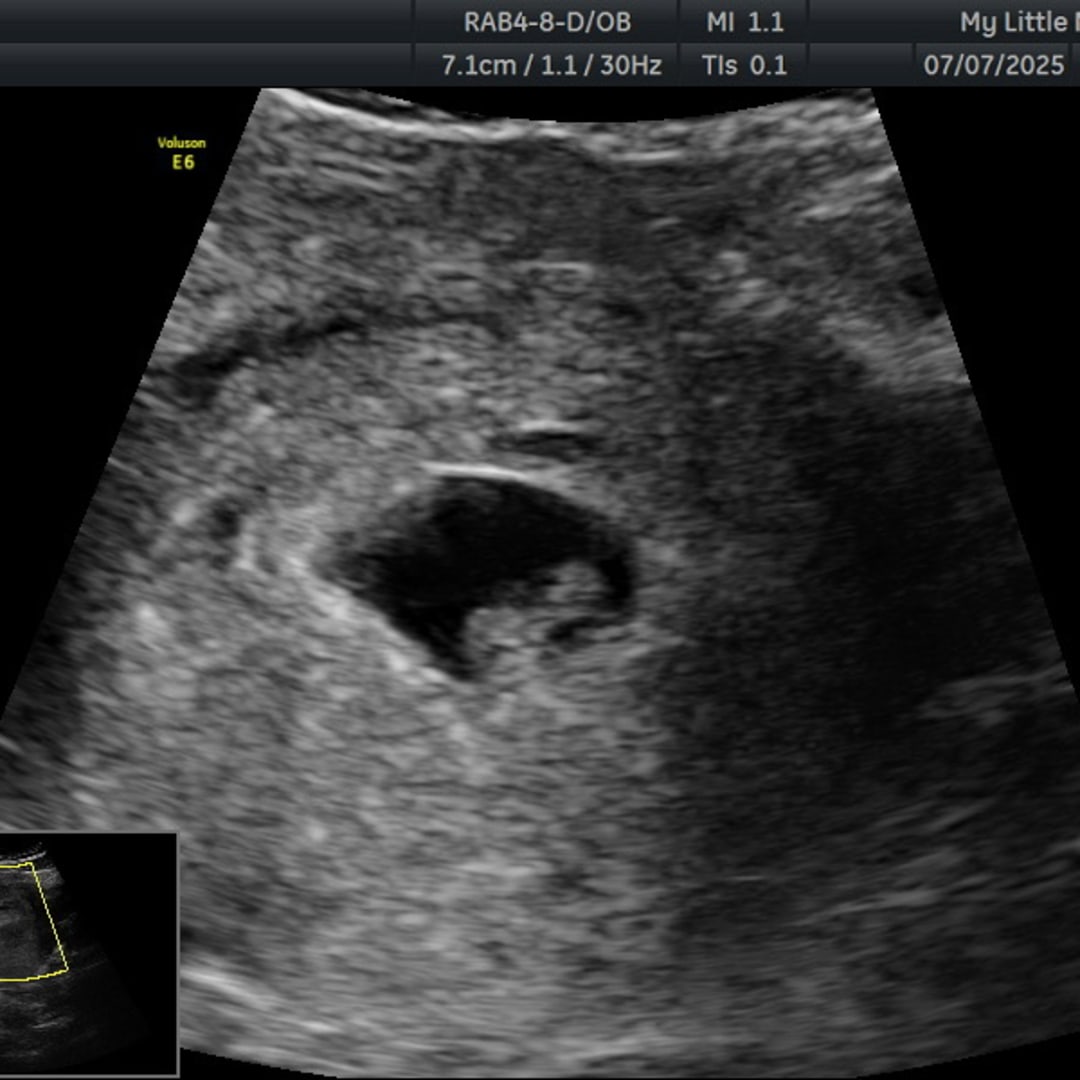 Photo shared by Kayla for their Babylist baby registry.
