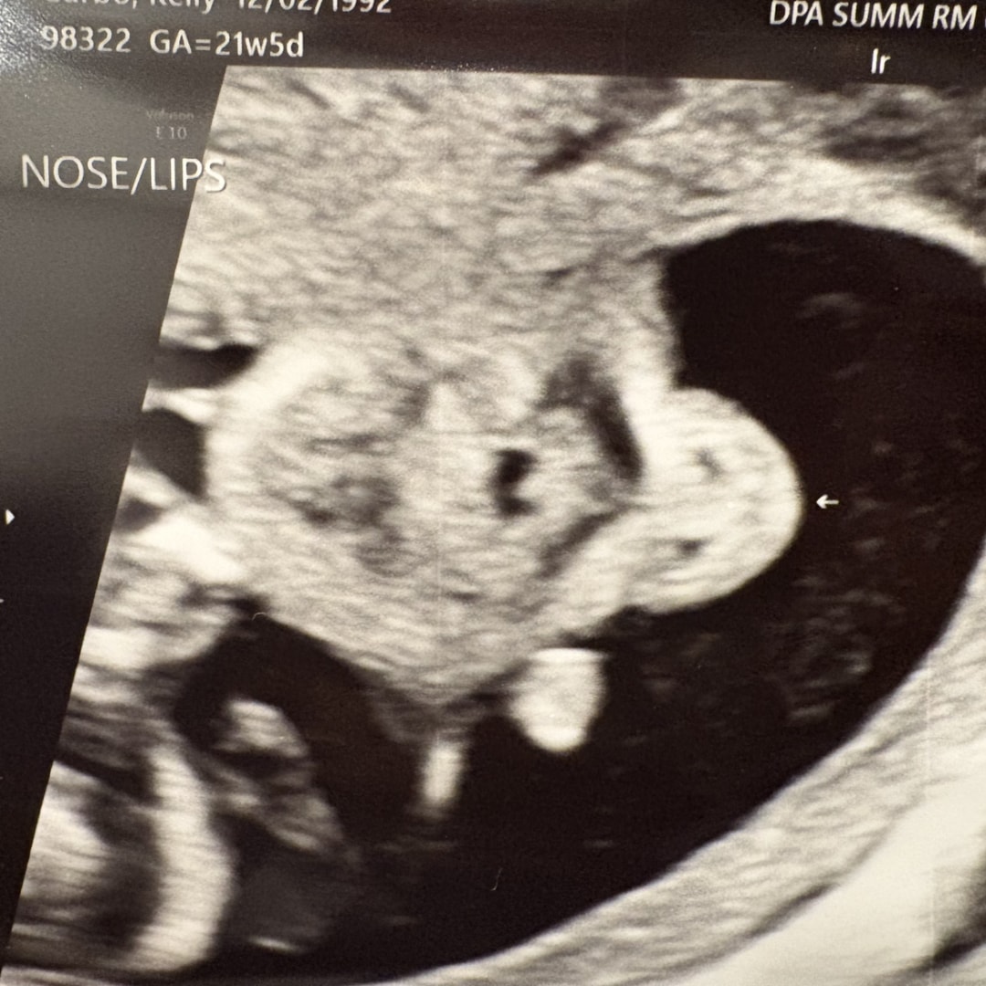 Photo shared by Kelley for their Babylist baby registry.