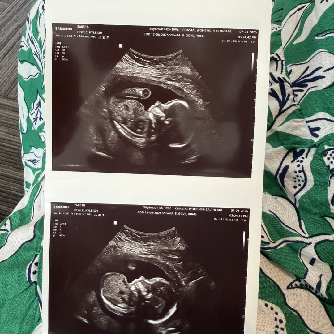 Photo shared by Kyleigh for their Babylist baby registry.