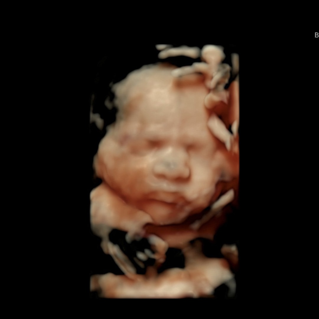 Photo shared by Shannon for their Babylist baby registry.