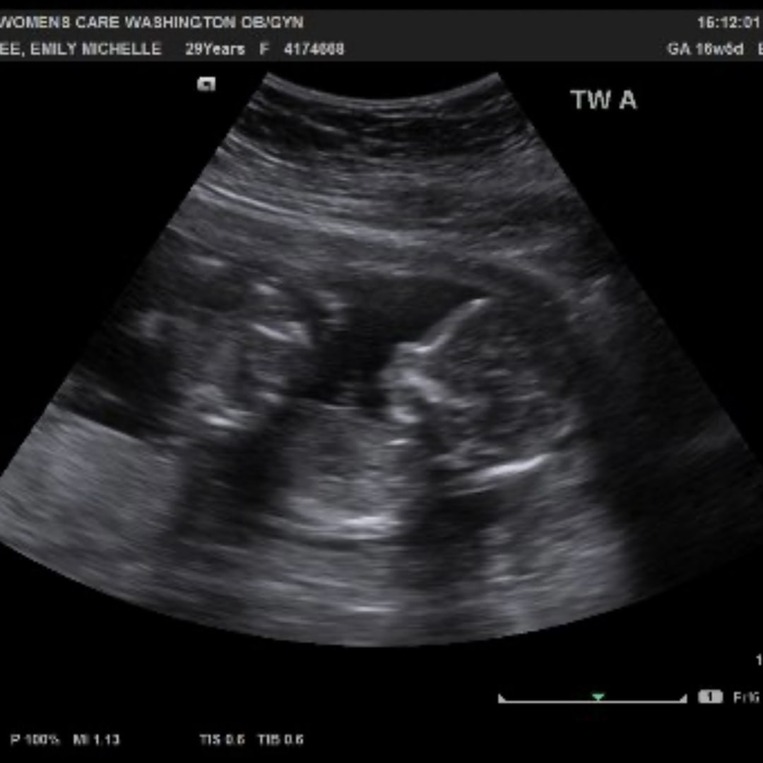 Photo shared by Emily for their Babylist baby registry.