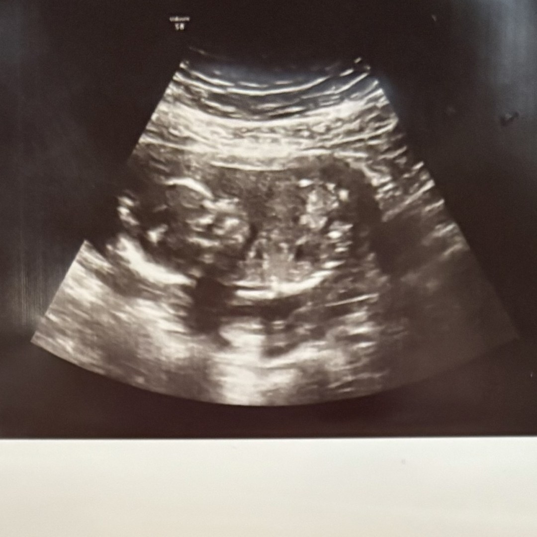 Photo shared by Emily for their Babylist baby registry.