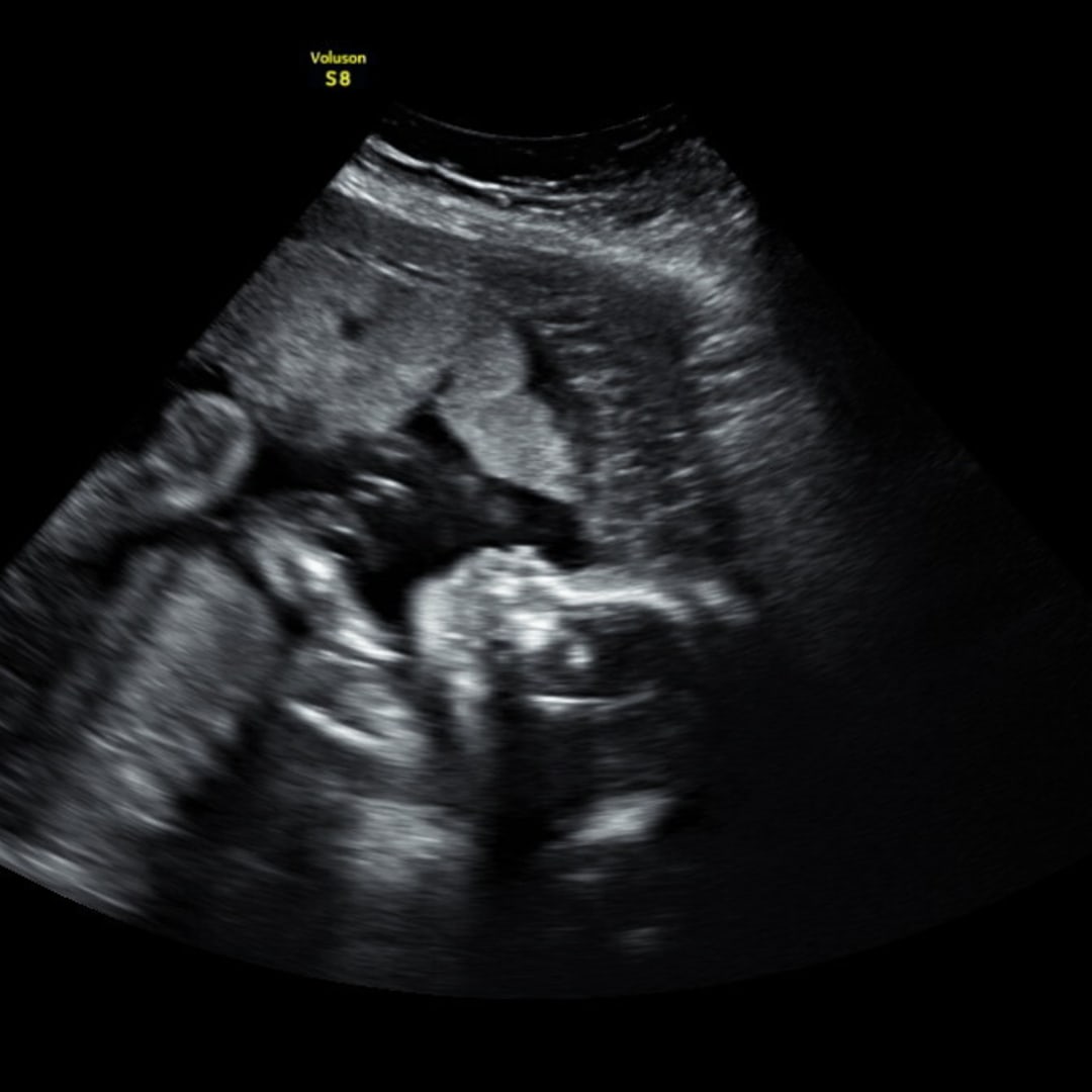 Photo shared by Carley for their Babylist baby registry.