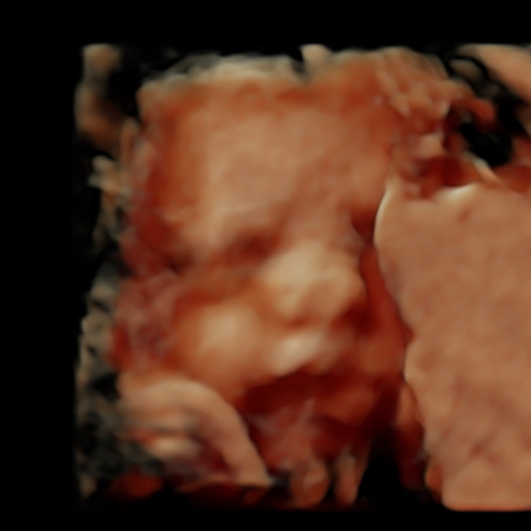 Photo shared by Abigail for their Babylist baby registry.