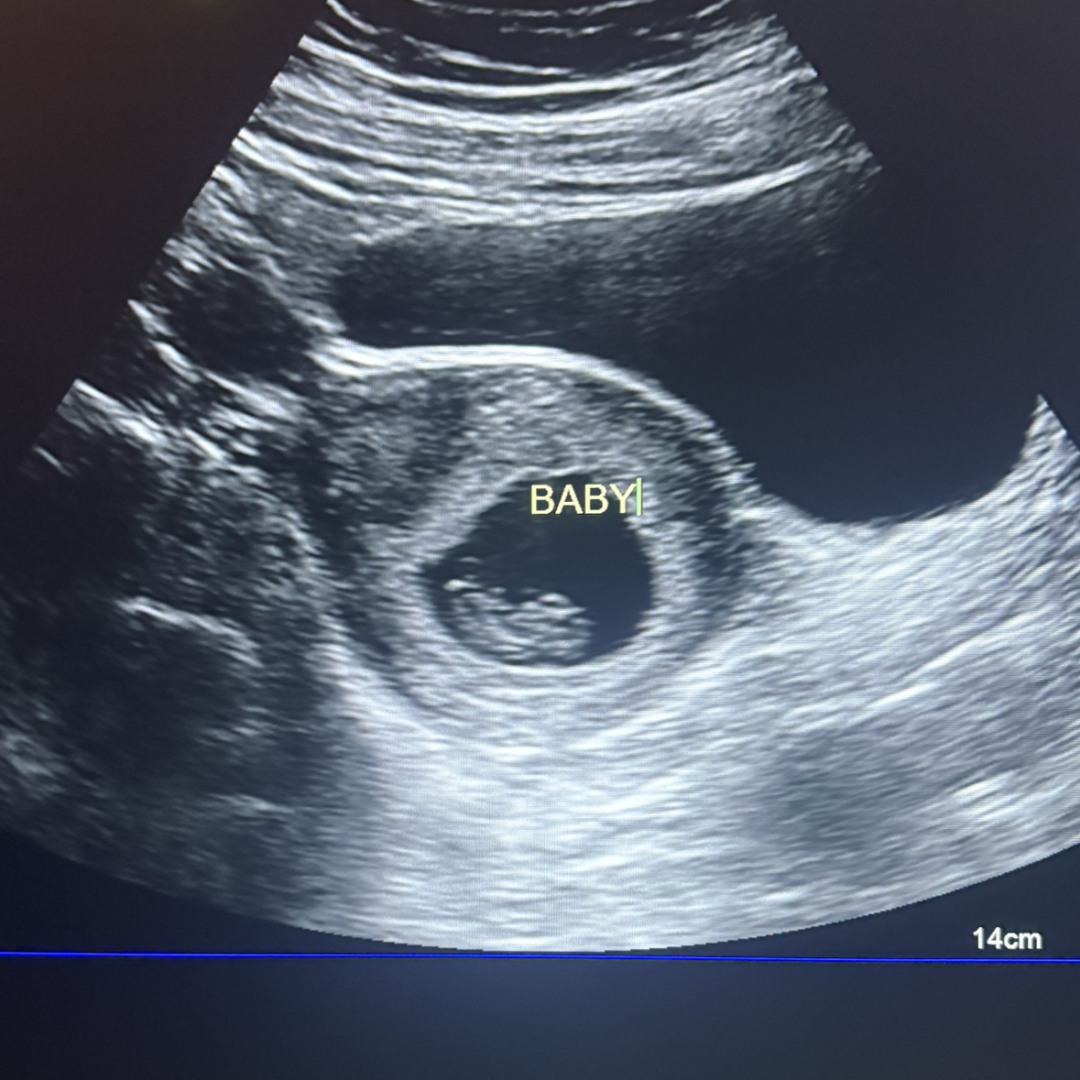 Photo shared by Heavenly for their Babylist baby registry.