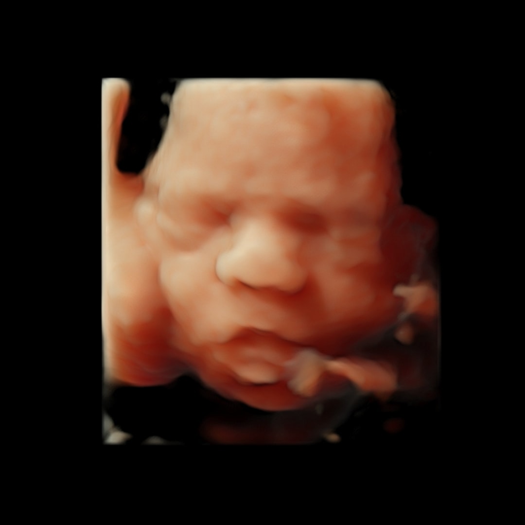 Photo shared by Hannah for their Babylist baby registry.