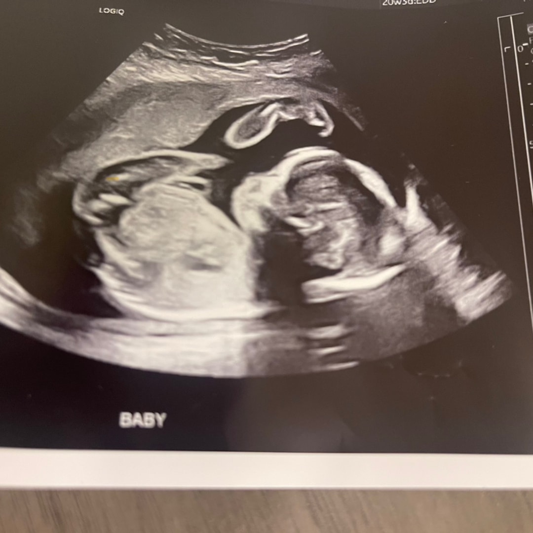 Photo shared by Anyssa for their Babylist baby registry.