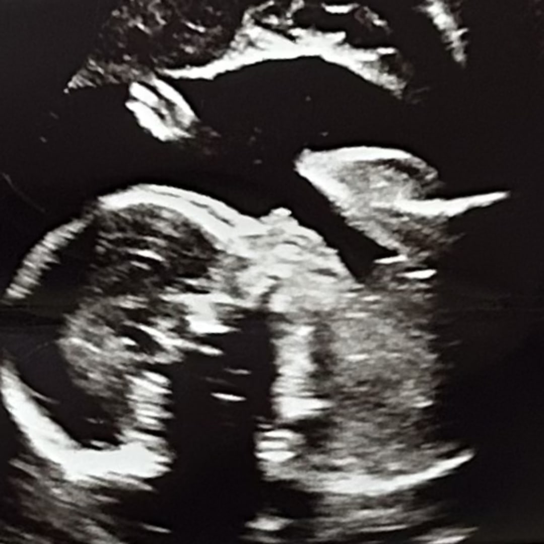 Photo shared by Atarrah for their Babylist baby registry.