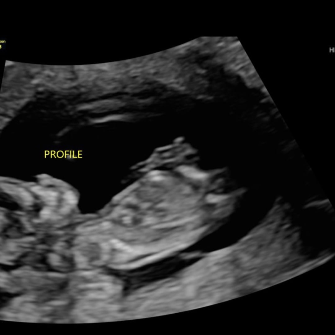 Photo shared by Erica for their Babylist baby registry.