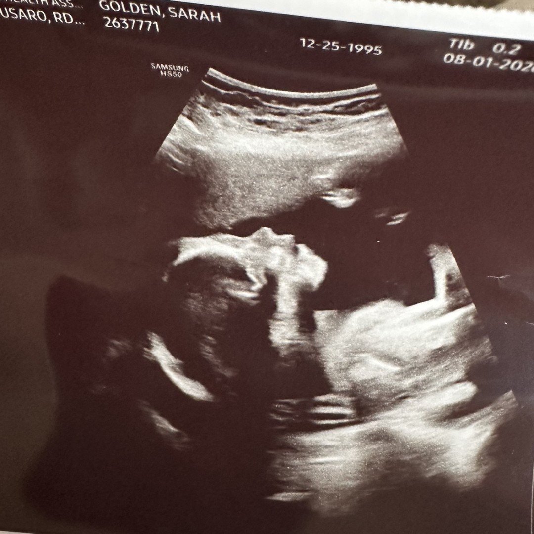 Photo shared by Sarah for their Babylist baby registry.