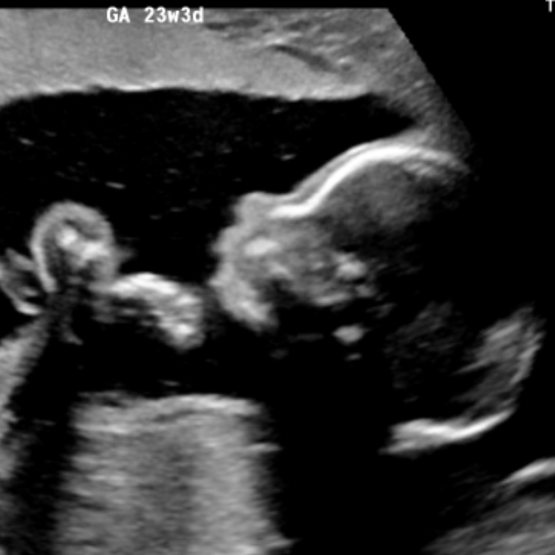 Photo shared by Dee for their Babylist baby registry.