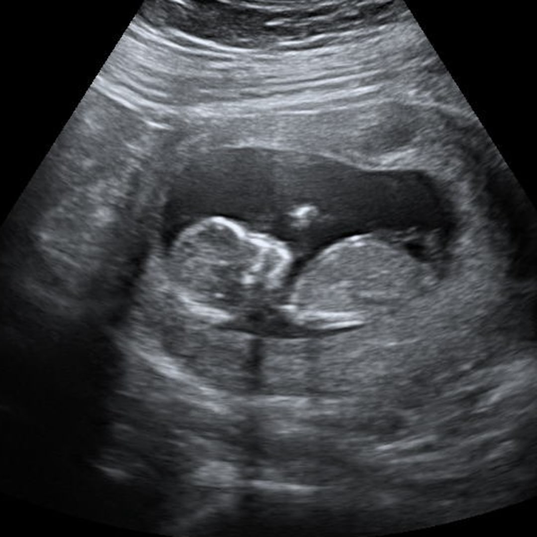 Photo shared by Cinthya for their Babylist baby registry.