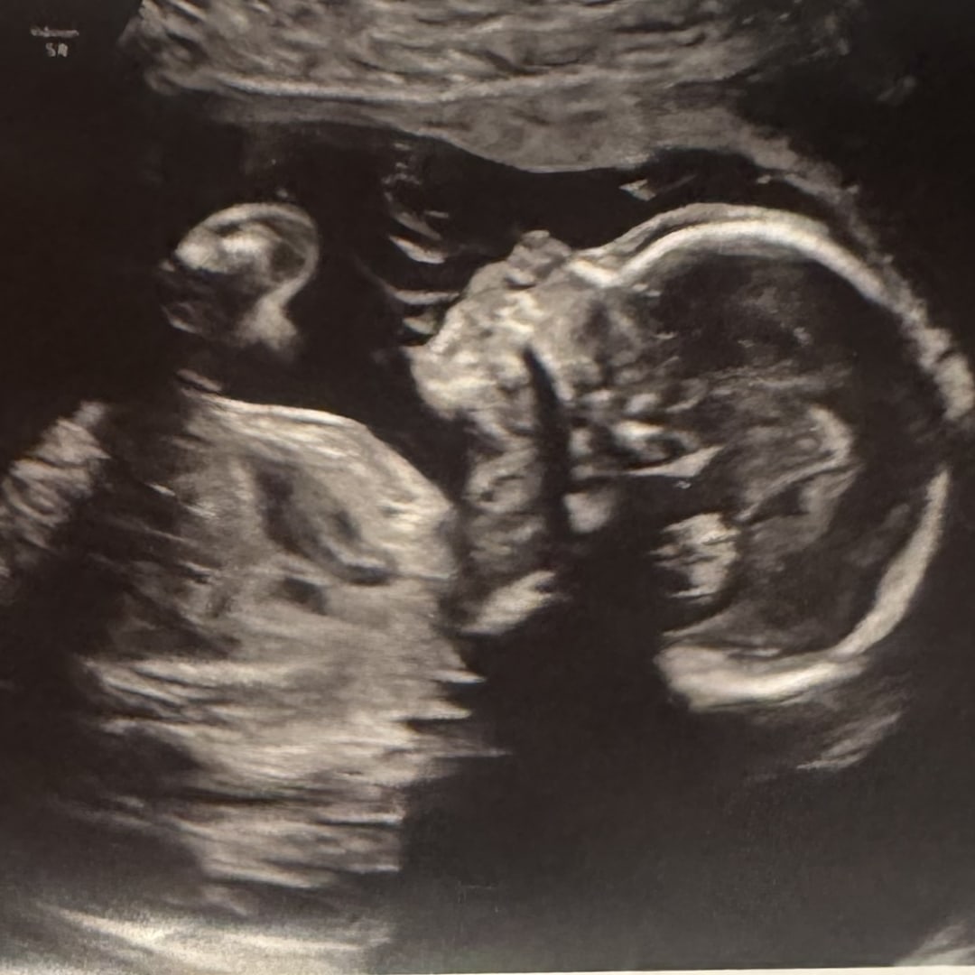 Photo shared by Addison for their Babylist baby registry.